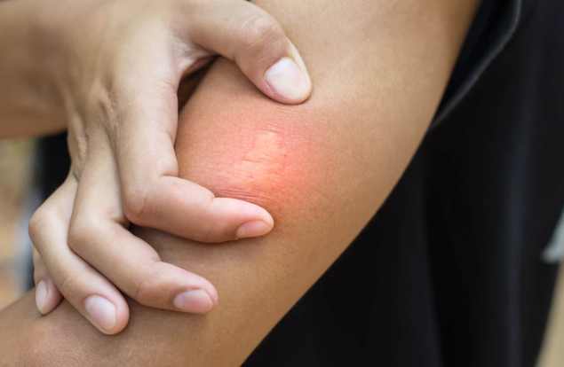 Can Bumble Bees Sting You Can Bumble Bees Sting You